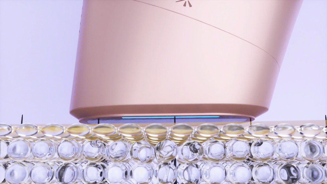 Best EVO Glow Pro Laser & IPL Hair Removal Devices for At-Home Use | Top Rated, Permanent Hair Reduction - Shop Now