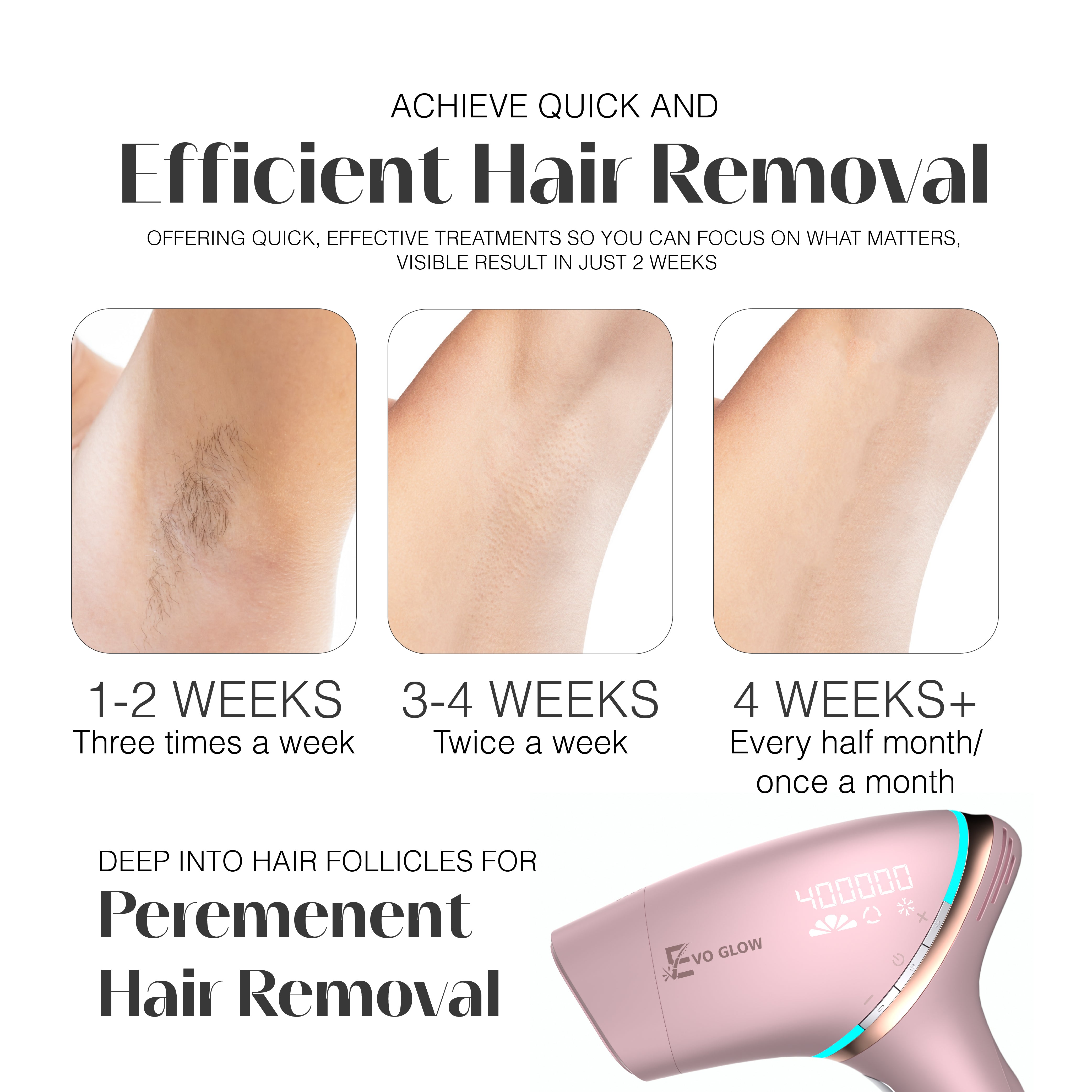 Evo Glow Pro - IPL Hair Removal Device